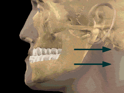 Cirurgia Ortognática