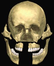 Trauma Facial